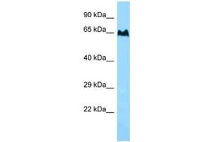 WB Suggested Anti-TBC1D3 Antibody Titration: 1. (TBC1D3 抗体  (C-Term))