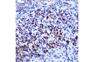 Immunohistochemistry of paraffin-embedded rat ovary using PALLD Rabbit pAb  at dilution of 1:100 (40x lens). (PALLD 抗体  (AA 383-672))