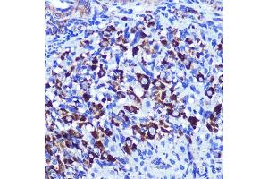 Immunohistochemistry of paraffin-embedded rat ovary using PALLD Rabbit pAb  at dilution of 1:100 (40x lens). (PALLD 抗体  (AA 383-672))