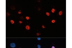 Immunofluorescence analysis of HeLa cells using HDAC3 Polyclonal Antibody at dilution of 1:100 (40x lens). (HDAC3 抗体)