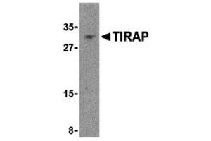 Western Blotting (WB) image for anti-Toll-Interleukin 1 Receptor (TIR) Domain Containing Adaptor Protein (TIRAP) (Middle Region) antibody (ABIN1031126) (TIRAP 抗体  (Middle Region))