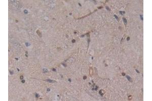 Detection of GSTt2 in Rat Spinal cord Tissue using Polyclonal Antibody to Glutathione S Transferase Theta 2 (GSTt2) (GSTT2 抗体  (AA 16-242))
