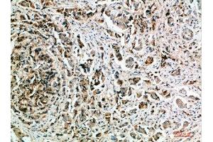 Immunohistochemistry (IHC) image for anti-Nanos Homolog 1 (NANOS1) (AA 151-200) antibody (ABIN7184522)