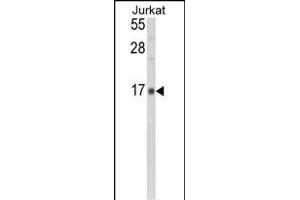 Western blot analysis of GMFG Antibody (N-term) (ABIN392351 and ABIN2841990) in Jurkat cell line lysates (35 μg/lane). (GMFG 抗体  (N-Term))