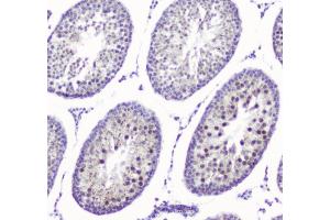 IHC analysis of SMC6L1 using anti-SMC6L1 antibody (ABIN5693133). (SMC6 抗体  (AA 205-443))
