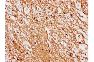 IHC image of ABIN7158375 diluted at 1:500 and staining in paraffin-embedded human brain tissue performed on a Leica BondTM system. (LIMD2 抗体  (AA 1-127))