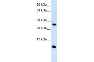 Western Blotting (WB) image for anti-Chemokine (C-C Motif) Ligand 18 (Pulmonary and Activation-Regulated) (CCL18) antibody (ABIN2463700)