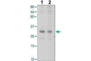 The tissue lysates derived from mouse liver (Lane 1), mouse muscle (Lane 2) were immunoprobed by SOCS2 polyclonal antibody  at 1 : 500. (SOCS2 抗体  (C-Term))