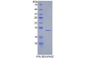 SDS-PAGE of Protein Standard from the Kit (Highly purified E.