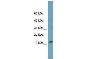 WB Suggested Anti-TRIM36 Antibody Titration:  0. (TRIM36 抗体  (Middle Region))