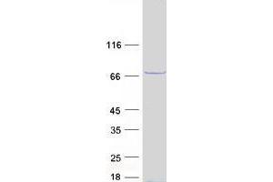Validation with Western Blot (YTHDF1 Protein (Myc-DYKDDDDK Tag))