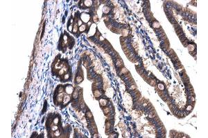IHC-P Image GNAQ antibody detects GNAQ protein at cell membrane and cytoplasm in rat intestine by immunohistochemical analysis. (GNAQ 抗体  (Center))