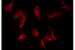 ABIN6275387 staining Hela by IF/ICC. (KCNQ5 抗体  (C-Term))