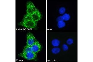 ABIN570702 Immunofluorescence analysis of paraformaldehyde fixed HepG2 cells, permeabilized with 0. (AGXT 抗体  (Internal Region))