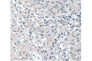 IHC-P analysis of Human Prostate Gland Tissue, with DAB staining. (APOA1 抗体  (AA 122-267))