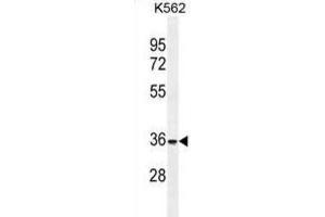 Western Blotting (WB) image for anti-Forkhead Box I3 (FOXI3) antibody (ABIN2996222) (FOXI3 抗体)