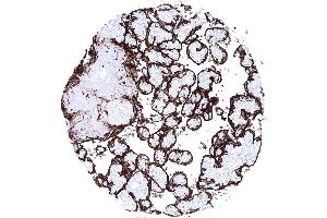 PLAP_Placenta (Recombinant PLAP 抗体)