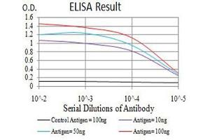 Black line: Control Antigen (100 ng),Purple line: Antigen (10 ng), Blue line: Antigen (50 ng), Red line:Antigen (100 ng) (AEBP2 抗体  (AA 358-495))