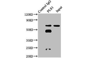 Immunoprecipitating PLS1 in 293 whole cell lysate Lane 1: Rabbit control IgG instead of ABIN7163552 in 293 whole cell lysate. (PLS1 抗体  (AA 1-143))