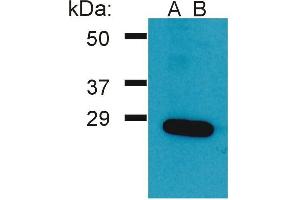 Western Blotting analysis (reducing conditions) of Ramos cell lysateusing two batches of rabbit anti-Grb2 polyclonal (A, B). (GRB2 抗体  (AA 198-217))