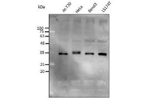 Anti-STUB1 Ab at 1/2,500 dilution, lysates at 50 µg per Iane, rabbit polyclonal to goat lgG (HRP) at 1/10,000 dilution, (STUB1 抗体)