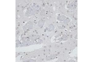 Immunohistochemistry of paraffin-embedded mouse brain using USP7/HAUSP antibody (ABIN6132280, ABIN6150032, ABIN6150034 and ABIN6217614) at dilution of 1:100 (40x lens). (USP7 抗体  (AA 206-1102))