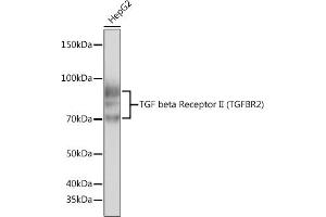 Western Blotting (WB) image for anti-Transforming Growth Factor, beta Receptor II (70/80kDa) (TGFBR2) antibody (ABIN7270914)