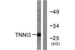 Western Blotting (WB) image for anti-Cardiac Troponin I (TNNI3) (AA 5-54) antibody (ABIN2888707) (TNNI3 抗体  (AA 5-54))