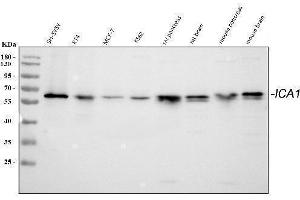 Western blot analysis of ICA1 using anti-ICA1 antibody (ABIN3042731).