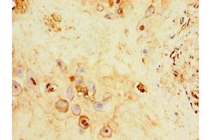 Immunohistochemistry of paraffin-embedded human placenta tissue using ABIN7175013 at dilution of 1:100 (C17orf58 抗体  (AA 21-90))