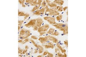Immunohistochemical analysis of paraffin-embedded H. (AK4 抗体  (AA 119-153))