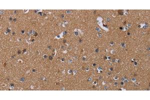 Immunohistochemistry of paraffin-embedded Human brain using PDE4A Polyclonal Antibody at dilution of 1:40 (PDE4A 抗体)