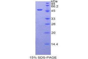 SDS-PAGE (SDS) image for Arrestin, beta 2 (ARRB2) (AA 262-430) protein (His tag,GST tag) (ABIN1877492) (Arrestin 3 Protein (AA 262-430) (His tag,GST tag))