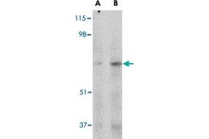 Western blot analysis of MAPKAP1 in human skeletal muscle tissue lysate with MAPKAP1 polyclonal antibody  at (A) 1 and (B) 2 ug/mL . (MAPKAP1 抗体  (Internal Region))