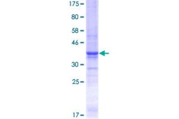Laminin alpha 5 Protein (AA 1-100) (GST tag)