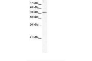 Image no. 1 for anti-Methyltransferase Like 3 (METTL3) (AA 206-255) antibody (ABIN202782) (METTL3 抗体  (AA 206-255))