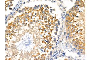 ABIN6258630 and ABIN6275109 at 1/100 staining Rat testis tissue by IHC-P.