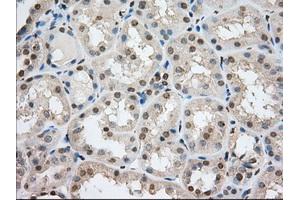 Image no. 12 for anti-Transforming, Acidic Coiled-Coil Containing Protein 3 (TACC3) antibody (ABIN1498097) (TACC3 抗体)