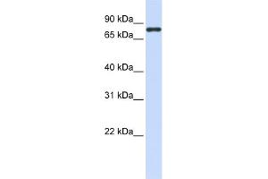 WB Suggested Anti-ACP6 Antibody Titration:  0. (ACP6 抗体  (N-Term))