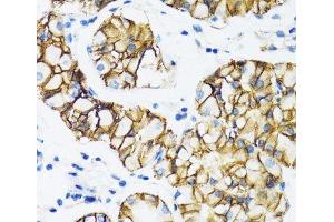 Immunohistochemistry (Paraffin-embedded Sections) (IHC (p)) image for anti-Catenin (Cadherin-Associated Protein), alpha 1, 102kDa (CTNNA1) antibody (ABIN7261582)