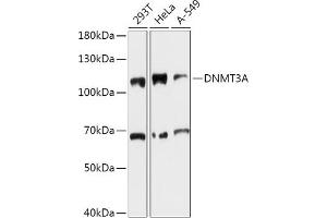 Western blot analysis of extracts of various cell lines, using DNMT3A antibody (ABIN6130284, ABIN6139747, ABIN6139749 and ABIN6215481) at 1:1000 dilution. (DNMT3A 抗体  (AA 500-700))