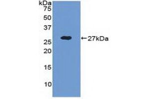 Detection of Recombinant ADAM17, Human using Polyclonal Antibody to A Disintegrin And Metalloprotease 17 (ADAM17) (ADAM17 抗体  (AA 226-473))