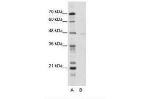 Image no. 1 for anti-Tripartite Motif Containing 38 (TRIM38) (N-Term) antibody (ABIN202589) (TRIM38 抗体  (N-Term))