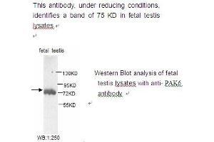 Image no. 1 for anti-P21-Activated Kinase 6 (PAK6) antibody (ABIN790802) (PAK6 抗体)