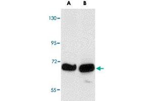 Western blot analysis of KLHL15 in HeLa cell lysate with KLHL15 polyclonal antibody  at (A) 1 and (B) 2 ug/mL .