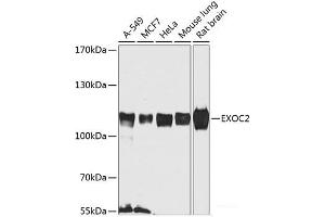 Western blot analysis of extracts of various cell lines using EXOC2 Polyclonal Antibody at dilution of 1:1000. (EXOC2 抗体)