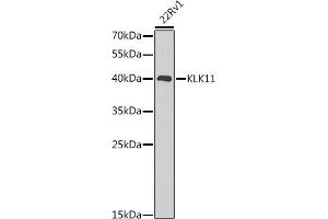 Western blot analysis of extracts of 22Rv1 cells, using KLK11 antibody (ABIN6129403, ABIN6142946, ABIN6142948 and ABIN6216242) at 1:1000 dilution. (Kallikrein 11 抗体  (AA 1-250))
