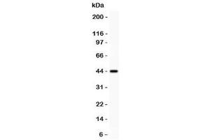 Western blot testing of Mesothelin antibody and recombinant human protein (0. (Mesothelin 抗体  (AA 306-576))