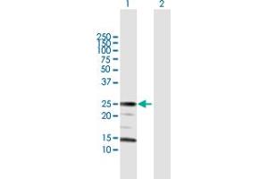 Western Blotting (WB) image for anti-rho GDP Dissociation Inhibitor (GDI) alpha (ARHGDIA) (AA 1-204) antibody (ABIN513488)