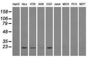 Image no. 6 for anti-Dihydrofolate Reductase (DHFR) antibody (ABIN1497822) (Dihydrofolate Reductase 抗体)